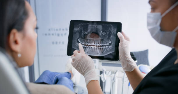 Licensed Tooth Extraction service in Alexandria, LA - Smile Center Dentistry